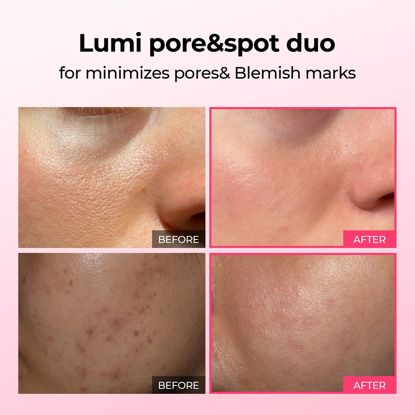 LUHAKA® Poren & Pickelpflege Duo