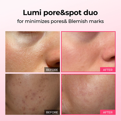 LUHAKA®  Poren & Pickelpflege Duo